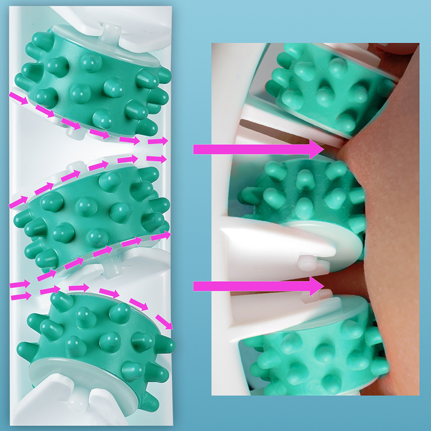 Tesmed Cellulite 5